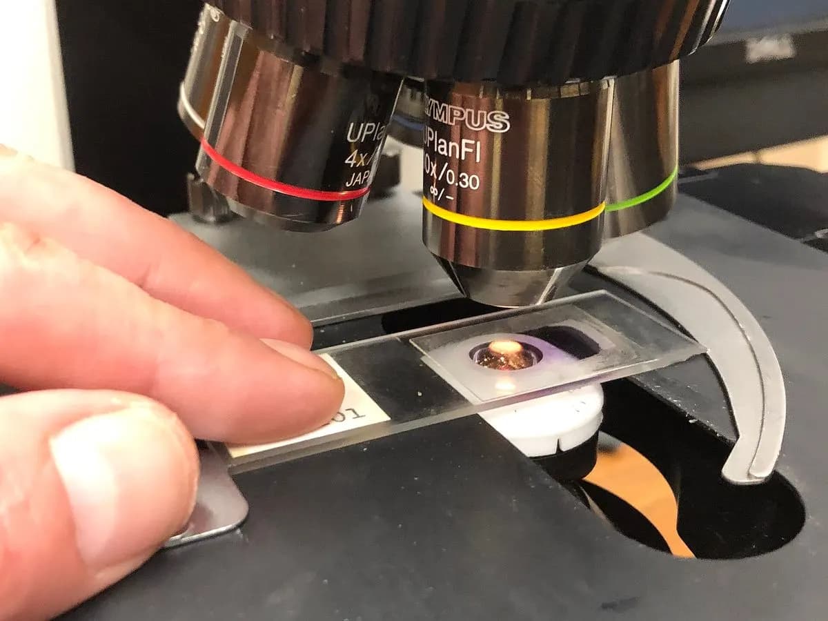 Lame histologique posée sur la platine d'un microscope, sous l'objectif