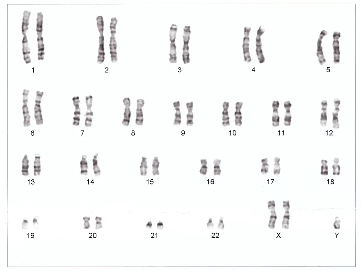 Caryotype humain : chromosomes classés par paires