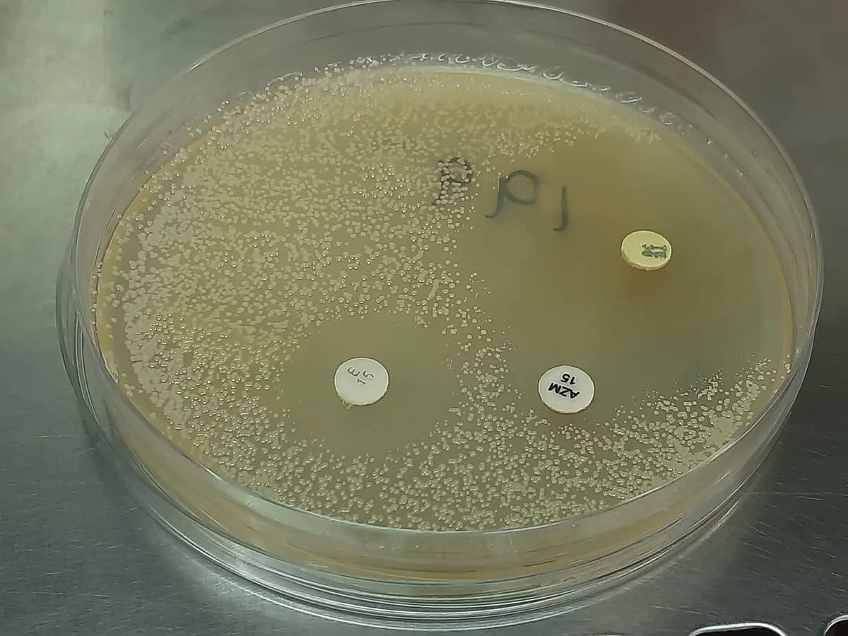 Antibiogramme sur gélose de Mueller-Hinton : disques d'antibiotiques et zones d'inhibition